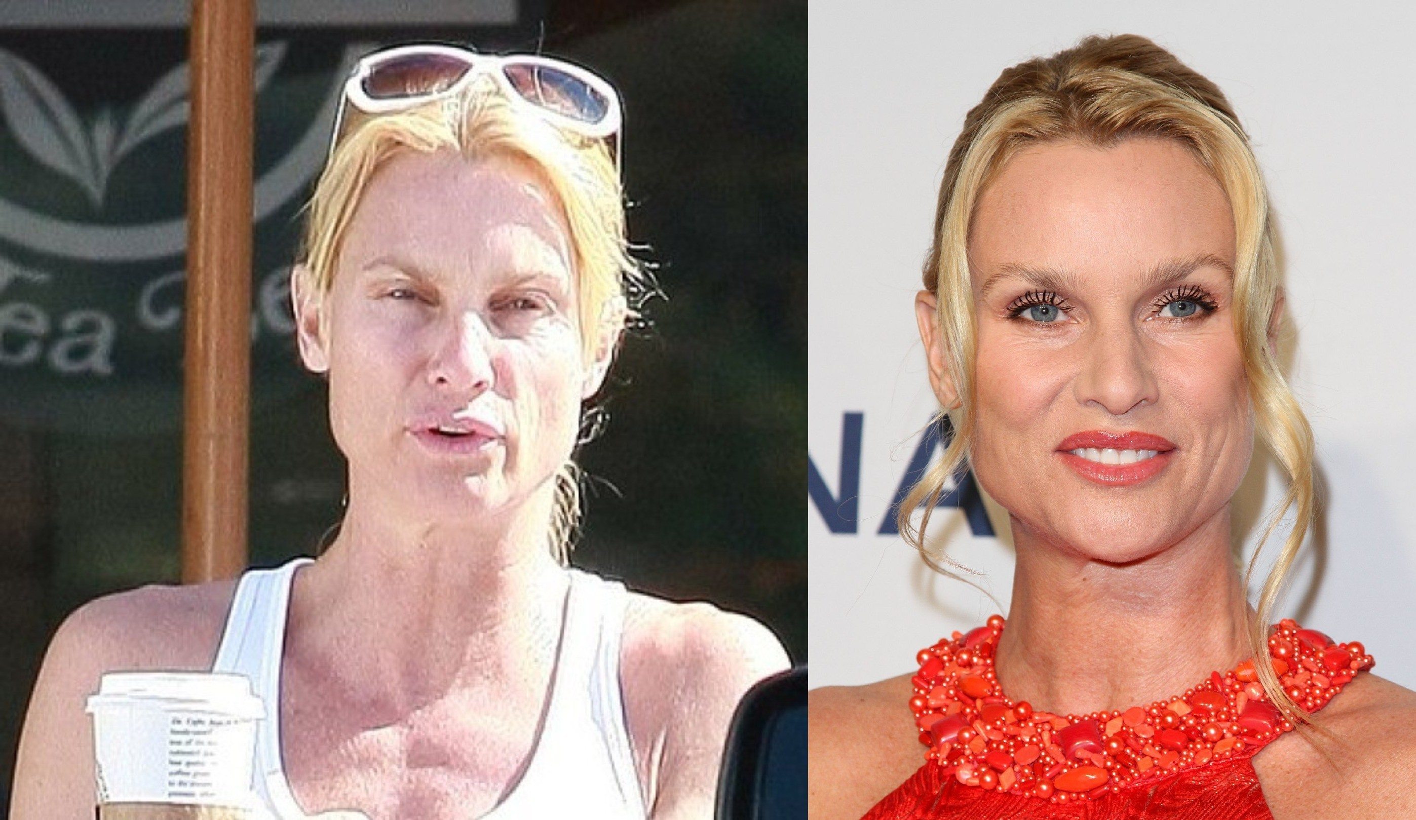 Check Out These 20 Embarrassing Photos of Celebrities Without Makeup
