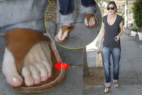Celebrities Who Have Ugly Feet