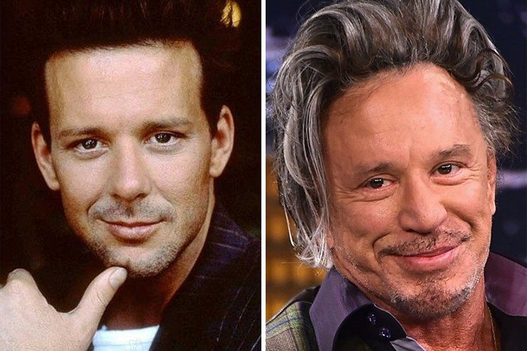 Plastic Surgery : 11 Male Stars You Didn't Know Have Had It