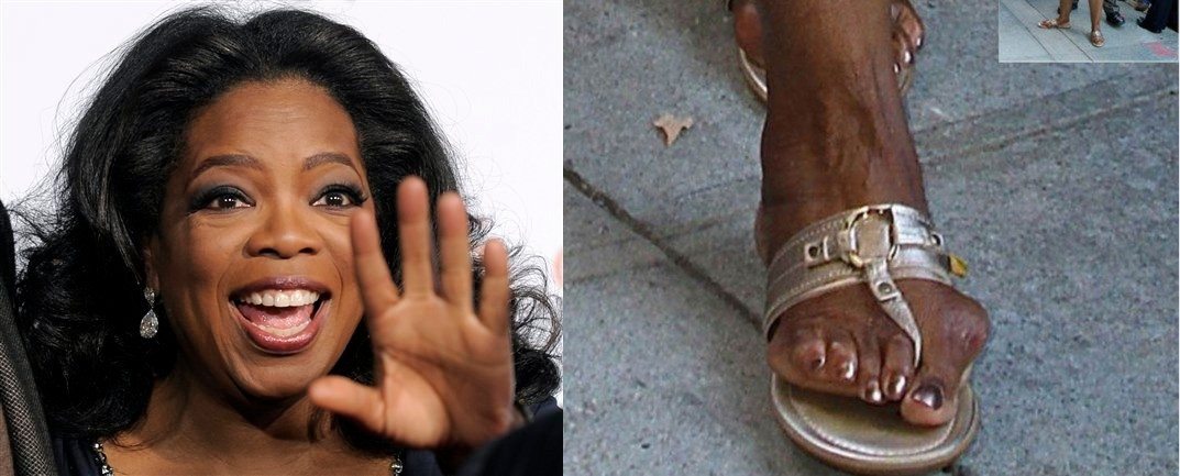 Celebrities Who Have Ugly Feet